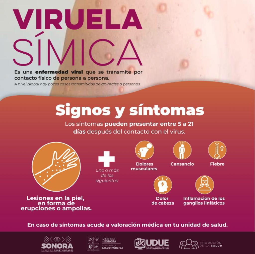 Confirma Secretaría de Salud dos casos de viruela símica en Sonora