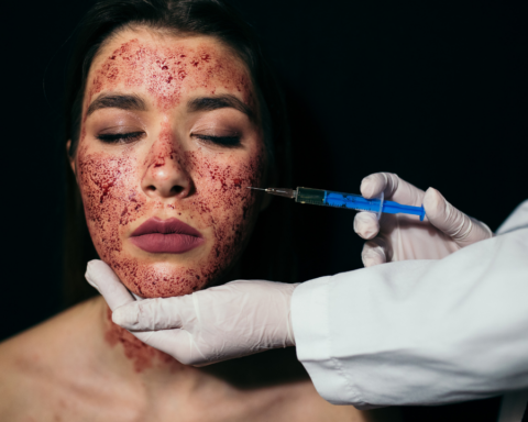 Alerta: 'Facial Vampiro' Causa Contagio de VIH en Spa