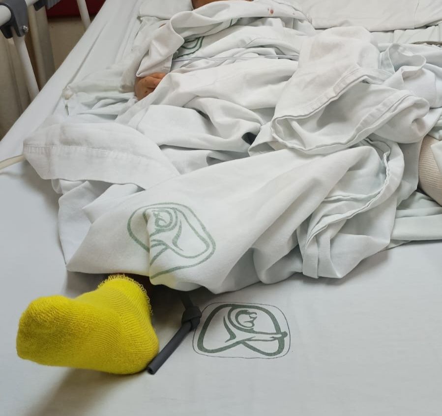 ¡Ayudemos a Alexander! Niño de 4 años atropellado en Nogales necesita apoyo urgente