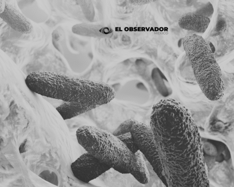 Klebsiella oxytoca
