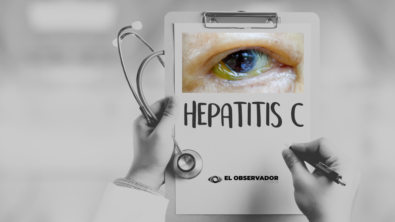 Hepatitis C