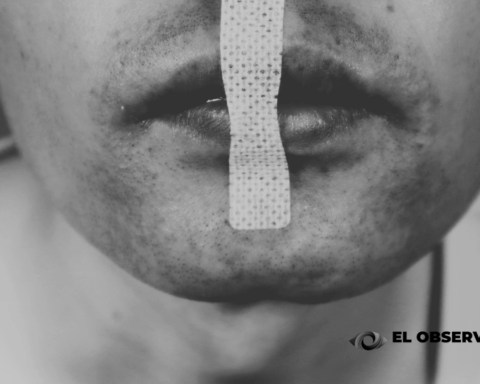 Mouth taping