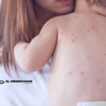 El sarampión ya se extendió por todo México